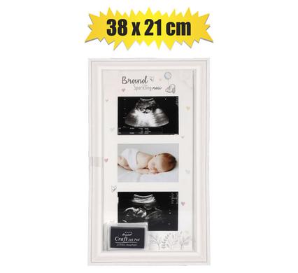 MDF 3-Section Ultrasound (Scan) Frame (38x21cm, Assorted)
